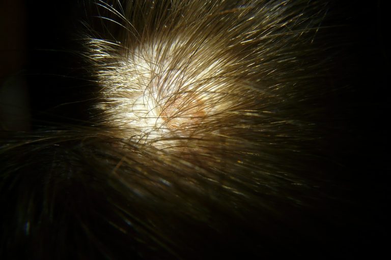 haarausfall und vitamine haarausfall und vitamine