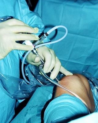 arthrose und selen