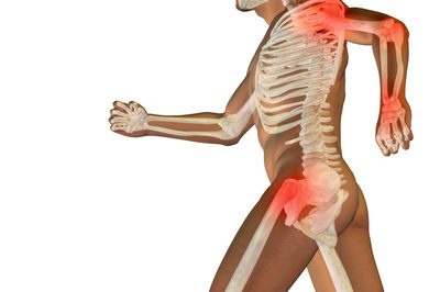 Chondroitin und Arthrose: wirksam Chondroitin und Arthrose: wirksam