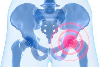 Glucosamin wirksam oder nicht? Glucosamin wirksam oder nicht?