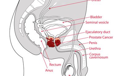 Prostata Prostata