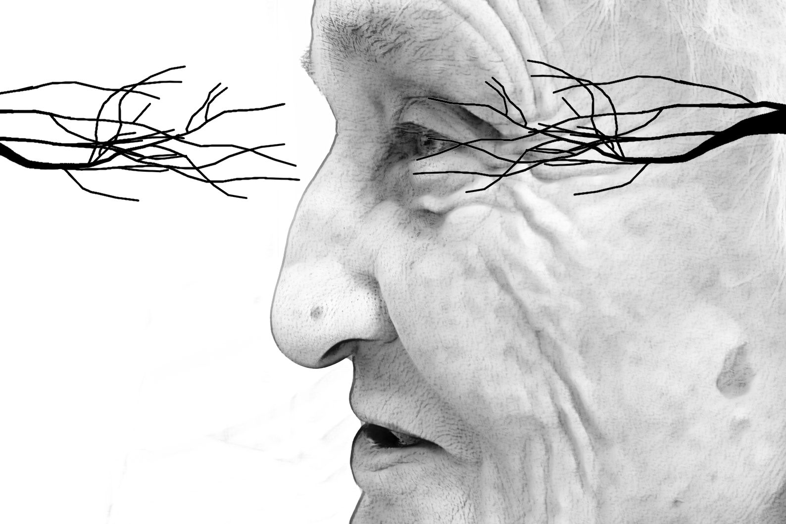 demenz vitamine ginkgo