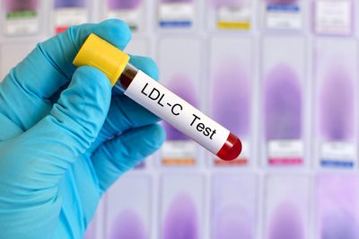 Cholesterin und Vitamin D Cholesterin und Vitamin D