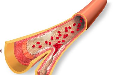 Cholesterinspiegel und Soyamilch Cholesterinspiegel und Soyamilch