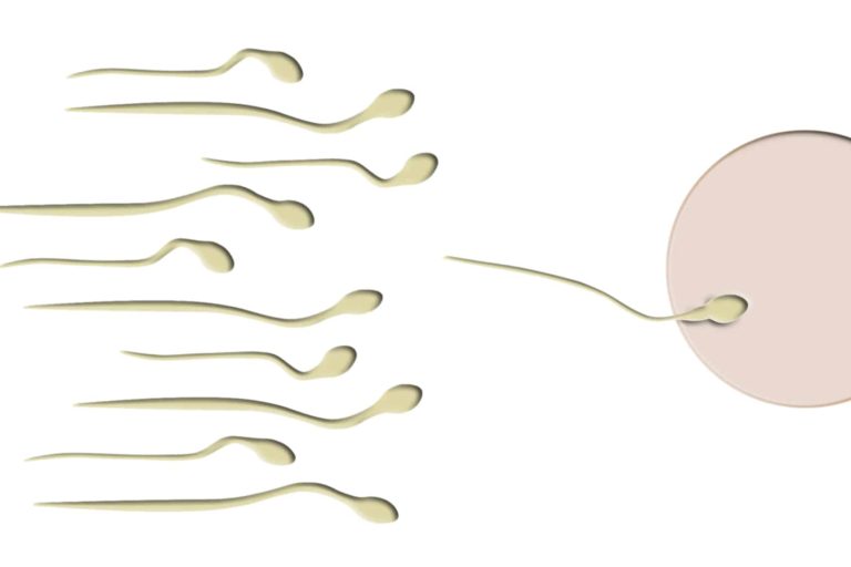 Spermiogramm verbessern Spermiogramm verbessern